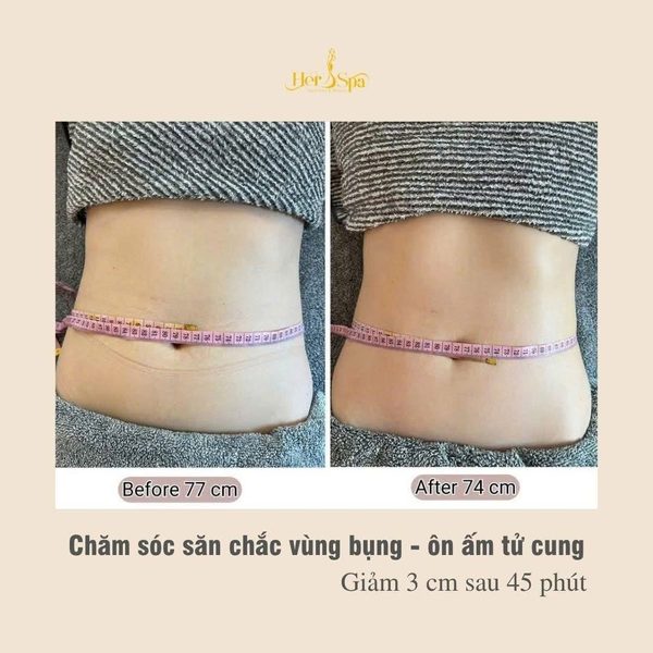 Kết quả trước sau