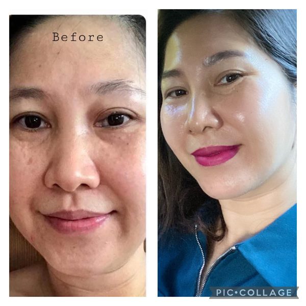 Kết quả trước sau